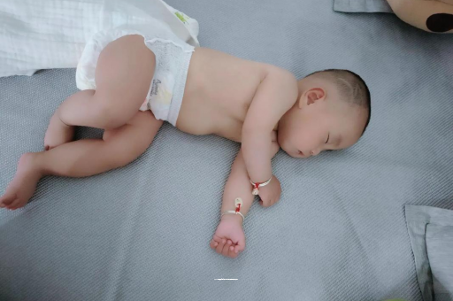 长宁六个月宝宝眼睛散光
